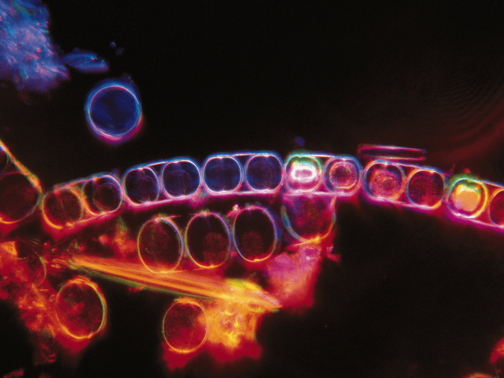 Diatoms Marine Tank: A Complete Guide to Managing and Preventing Diatom Growth 2 image 50
